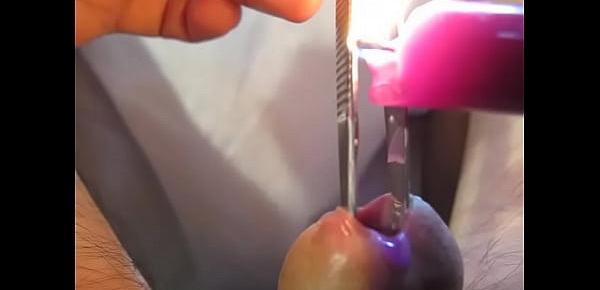  Urethra in hot purple wax